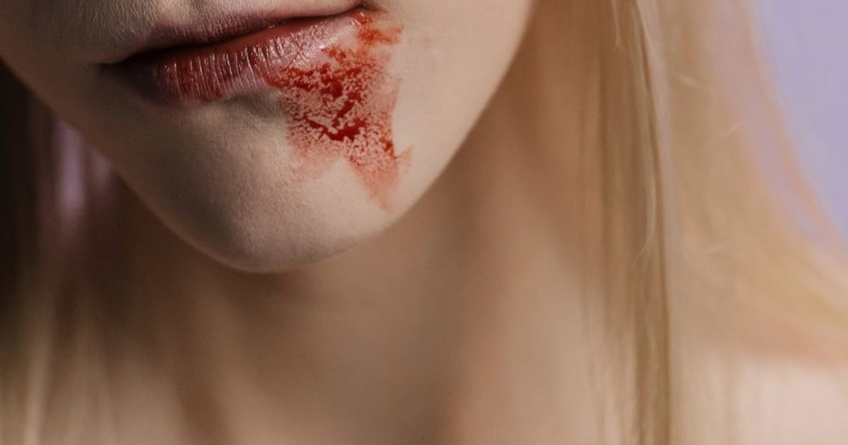 Detailed close-up of lips with a blood stain on the skin, highlighting texture and drama.